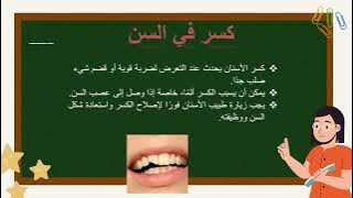 Read more about the article مشاكل  الاسنان